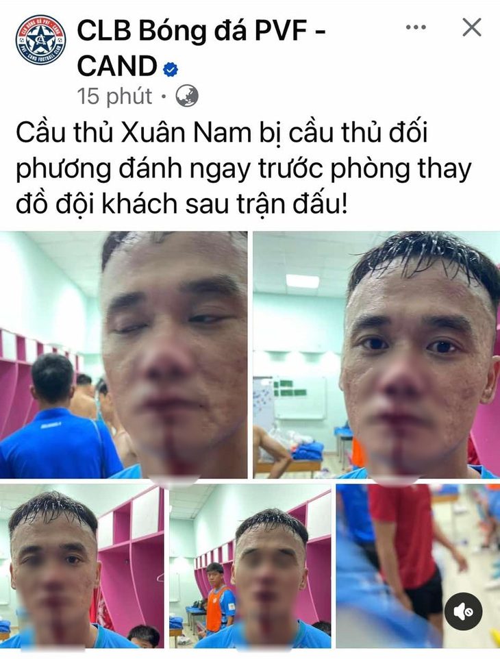 Cầu thủ trẻ TP.HCM đánh nhau với PVF-CAND - Ảnh 1.